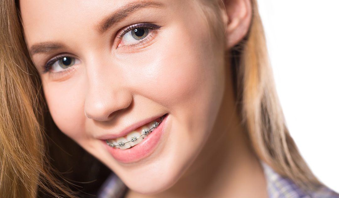 Adult Braces – 8 Myths About Getting Adult Braces