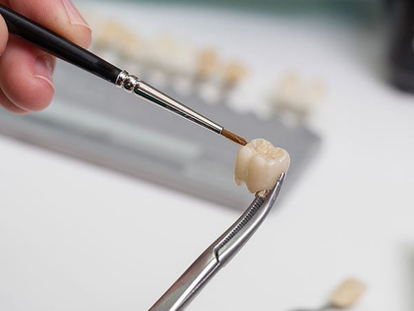 dentist_chapnick_uber_menu_45