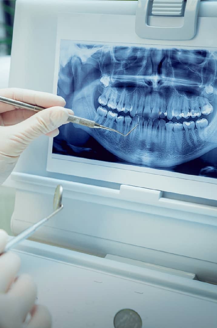 dentist_chapnick_uber_menu_49