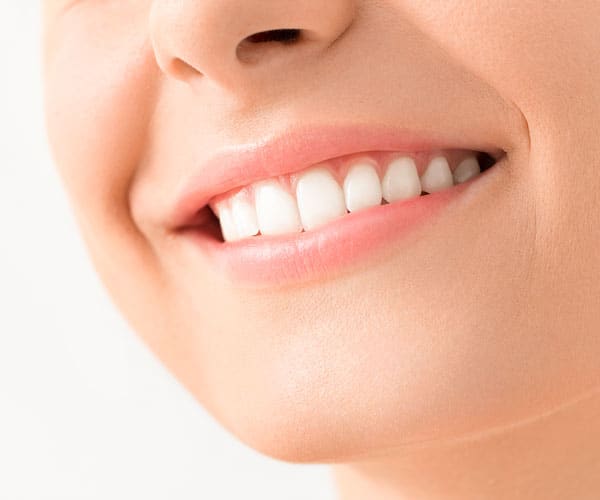 Smile-Makeover-Gallery